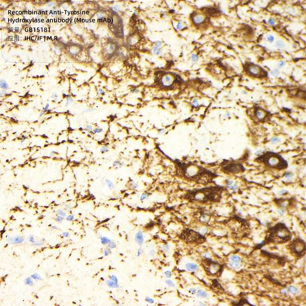 Антитела первичные, моноклональные, Tyrosine Hydroxylase, 100 мкл