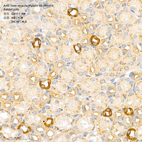 Антитела первичные, поликлональные, non-muscle Myosin IIB/MYH10, 100 мкл