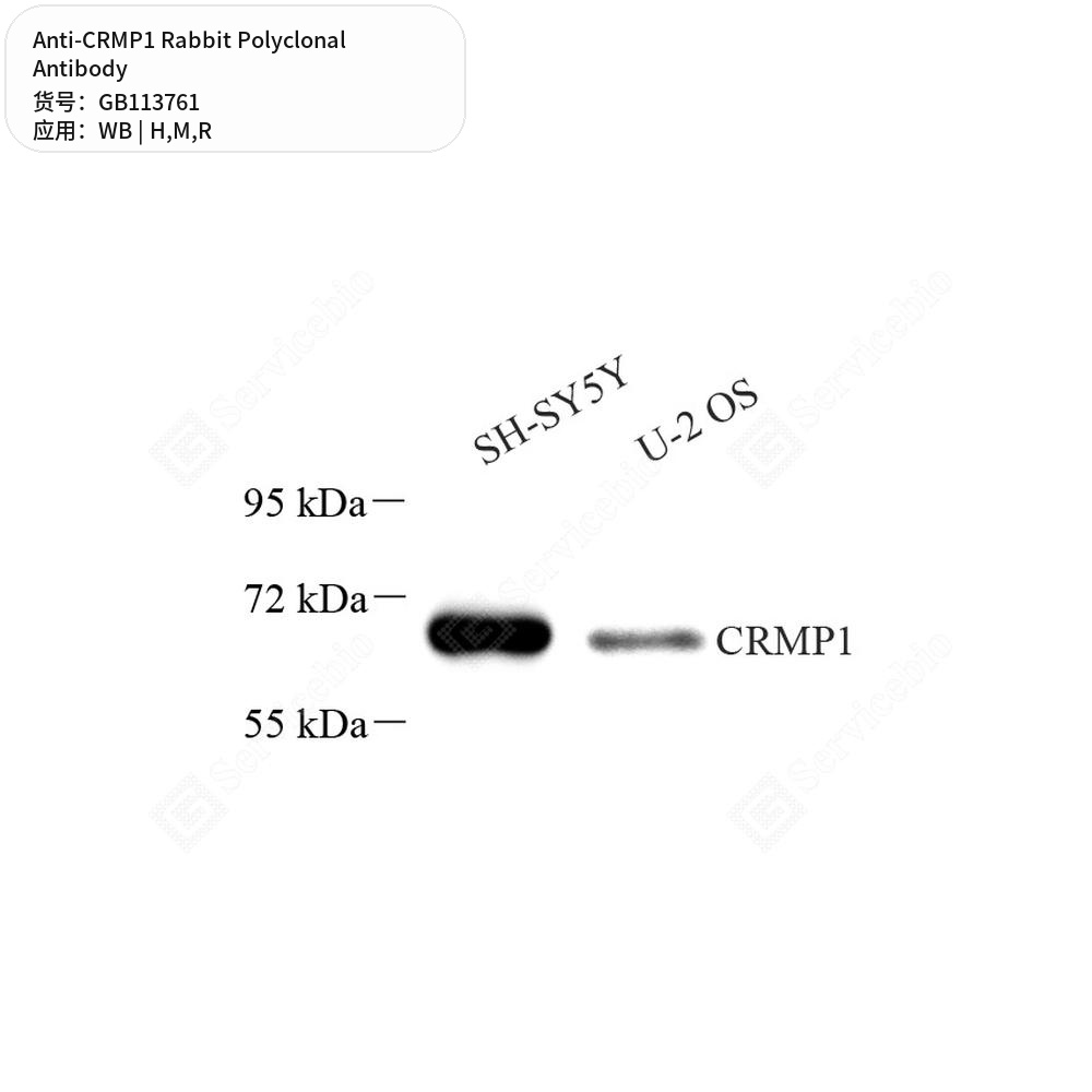 Антитела первичные, поликлональные кролика к CRMP1 крысы, мыши, человека, 50 мкл