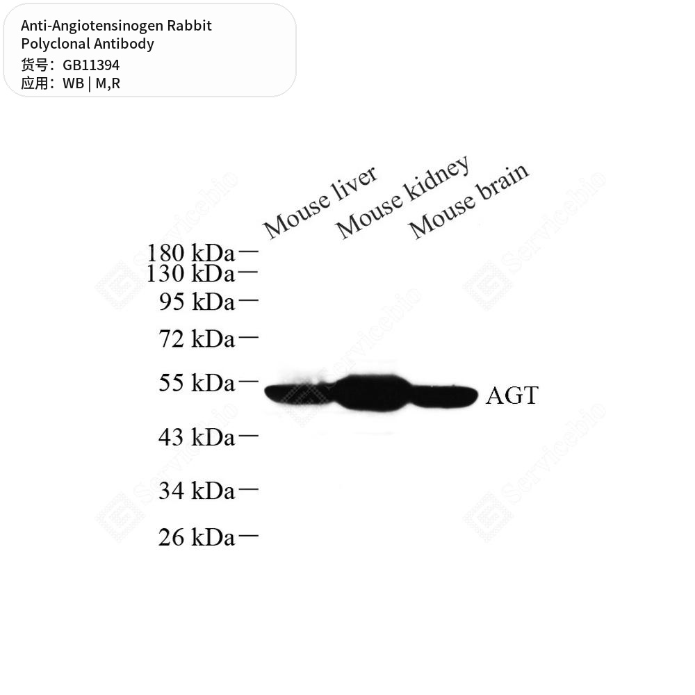 Антитела первичные, поликлональные кролика к Angiotensinogen крысы, мыши, 50 мкл