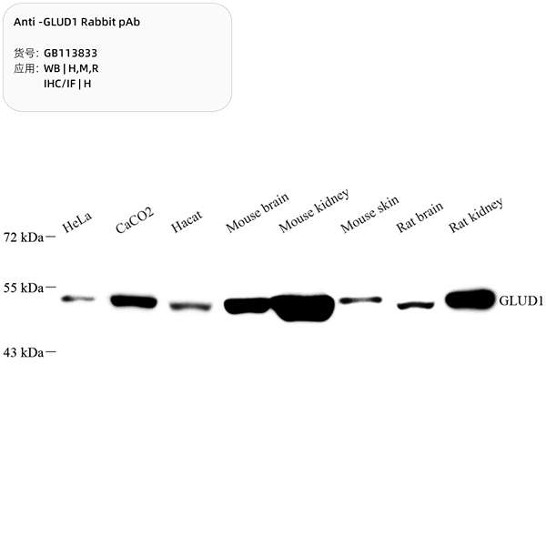 Антитела первичные, поликлональные, GLUD1, 100 мкл