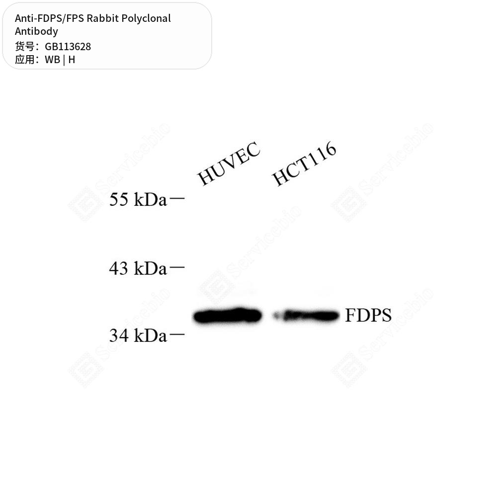 Антитела первичные, поликлональные кролика к FDPS/FPS человека, 100 мкл