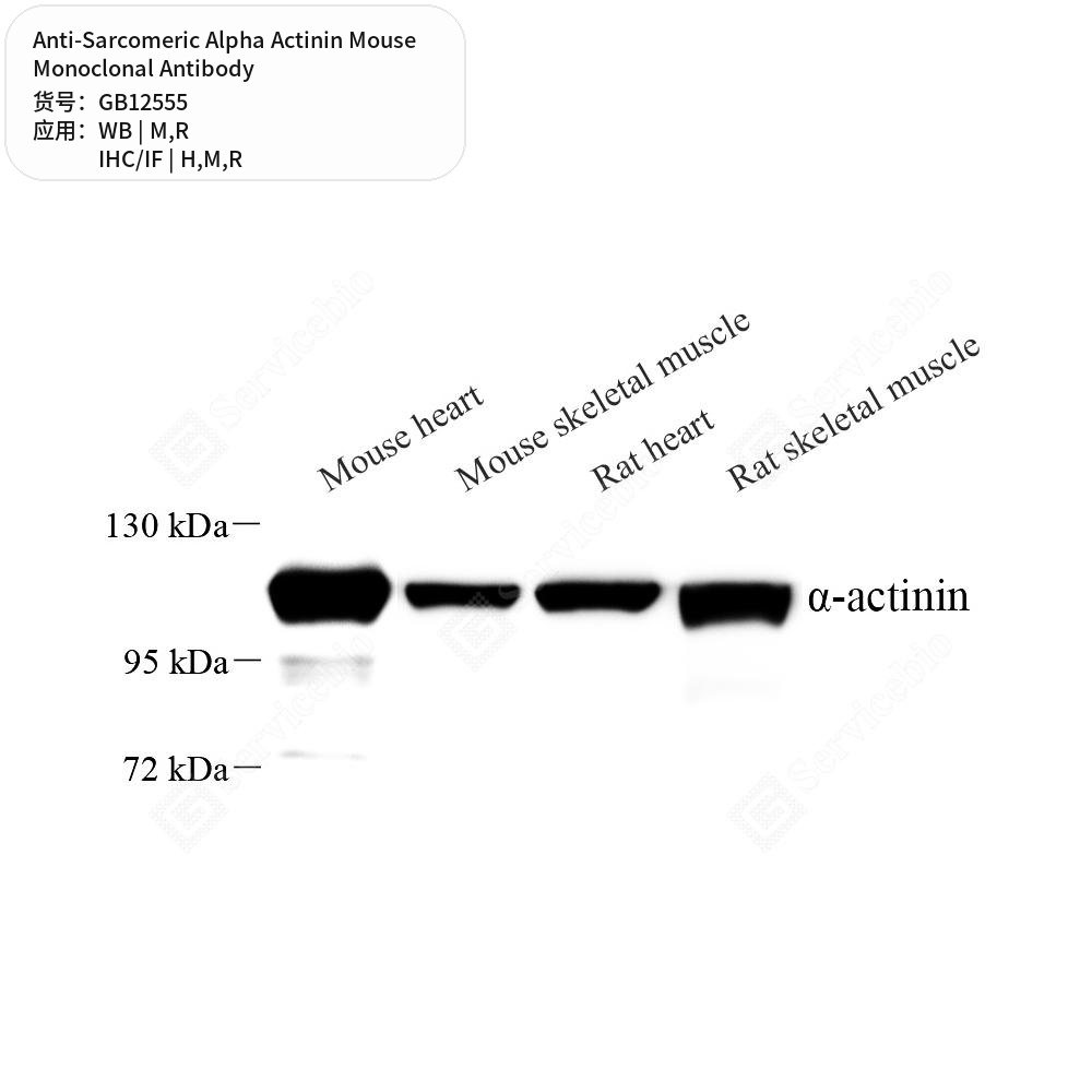 Антитела первичные, моноклональные мыши к Sarcomeric Alpha Actinin крысы, мыши, человека, 100 мкл