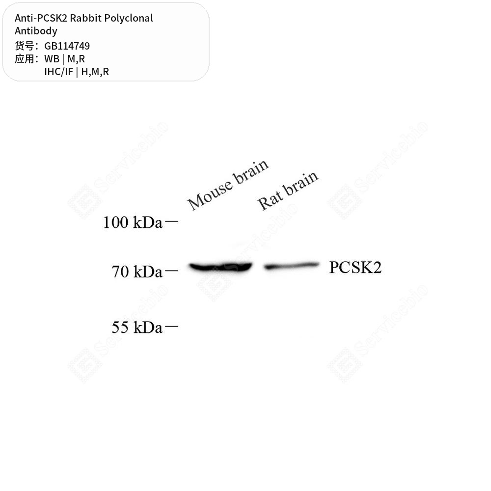 Антитела первичные, поликлональные кролика к PCSK2 крысы, мыши, человека, 50 мкл