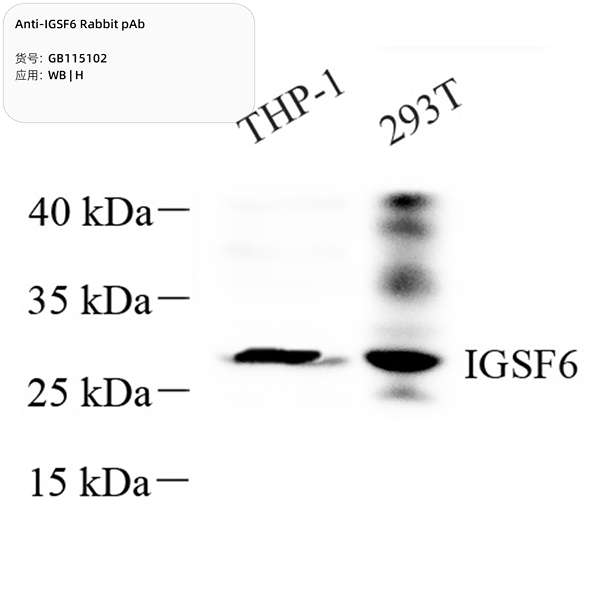 Антитела первичные, поликлональные, IGSF6, 100 мкл