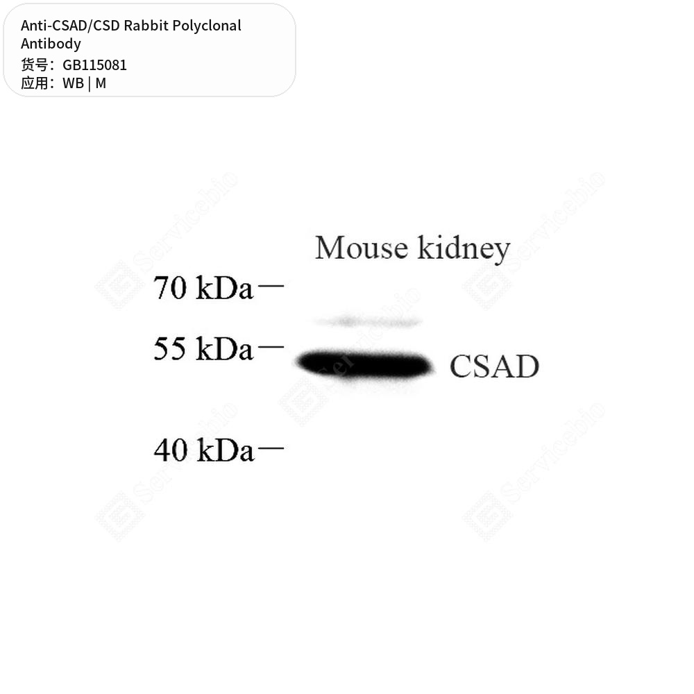 Антитела первичные, поликлональные кролика к CSAD/CSD мыши, 50 мкл