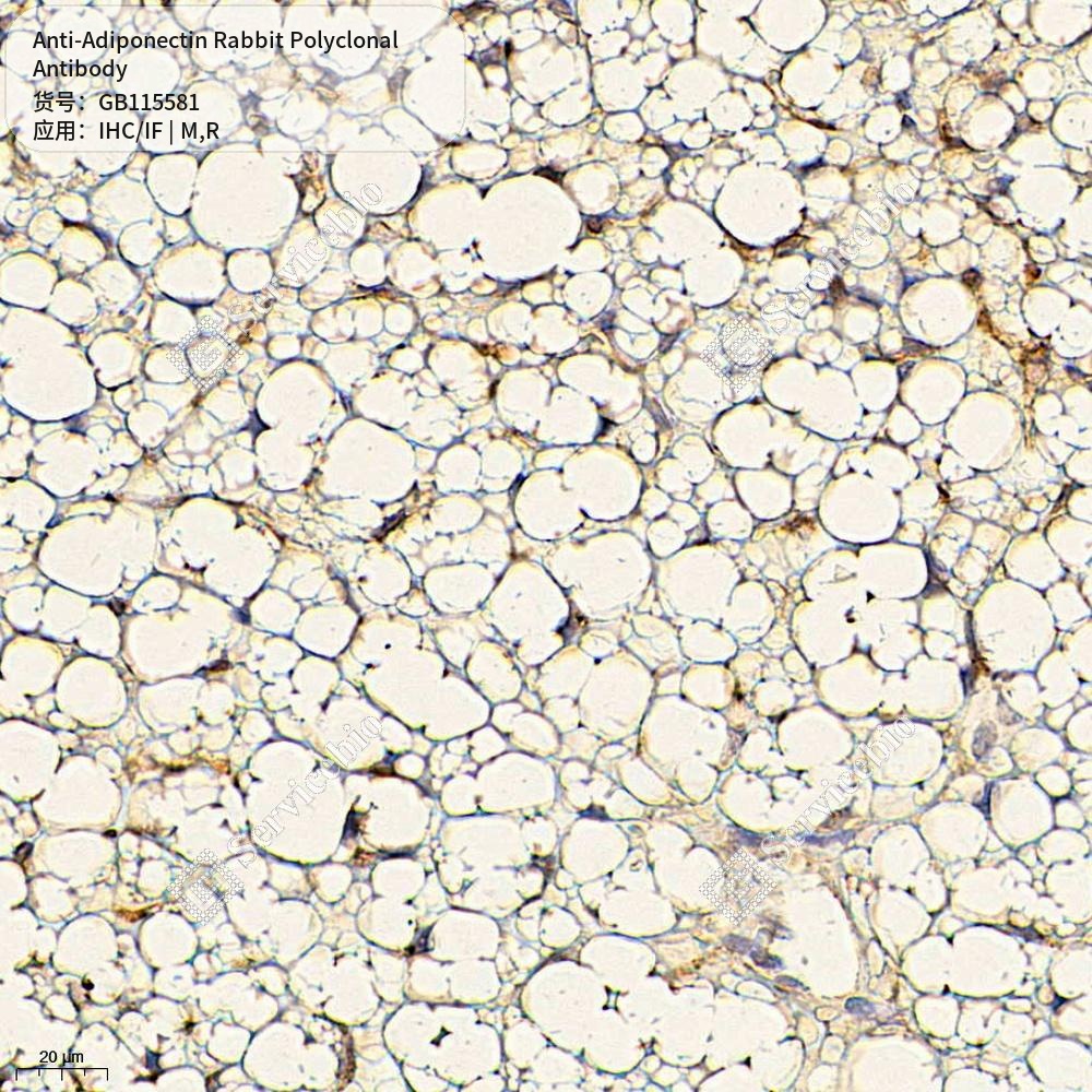 Антитела первичные, поликлональные кролика к Adiponectin крысы, мыши, 100 мкл