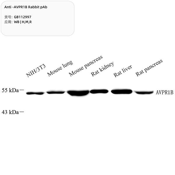 Антитела первичные, поликлональные, AVPR1B, 100 мкл