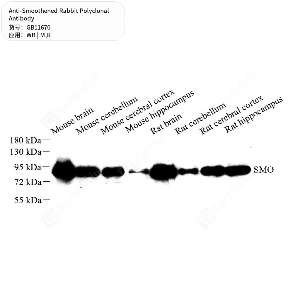 Антитела первичные, поликлональные кролика к Smoothened крысы, мыши, 100 мкл