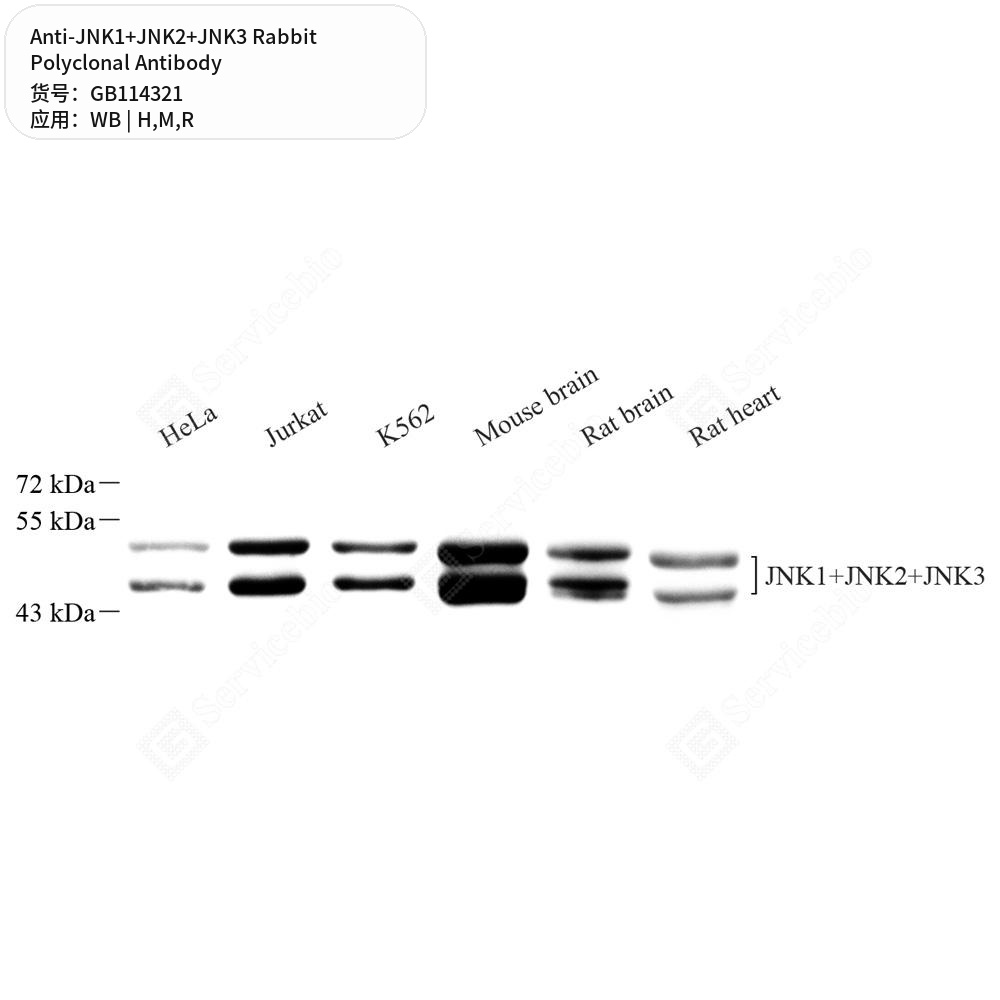 Антитела первичные, поликлональные кролика к JNK1+JNK2+JNK3 крысы, мыши, человека, 50 мкл