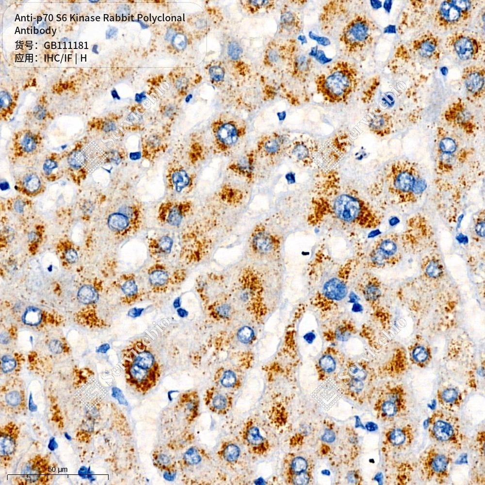 Антитела первичные, поликлональные кролика к p70 S6 Kinase человека, 100 мкл