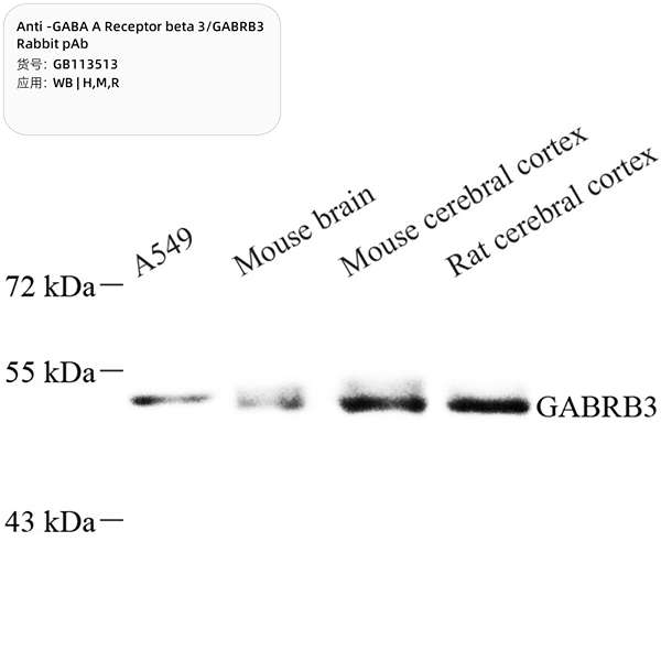 Антитела первичные, поликлональные, GABA A Receptor beta 3/GABRB3, 100 мкл
