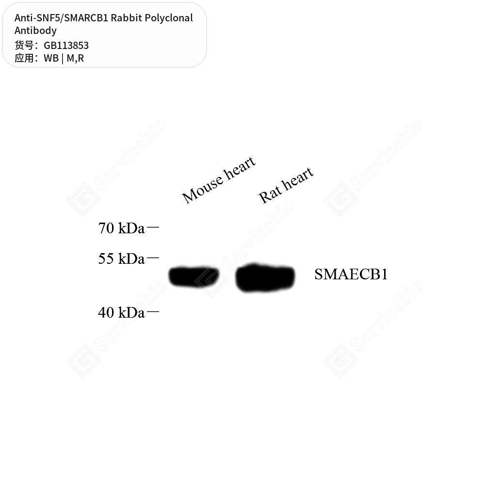 Антитела первичные, поликлональные кролика к SNF5/SMARCB1 крысы, мыши, 100 мкл