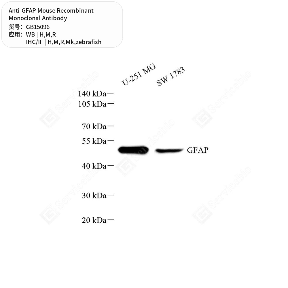 Антитела первичные, моноклональные мыши к GFAP Danio rerio, крысы, мыши, обезьяны, чел., 100 мкл
