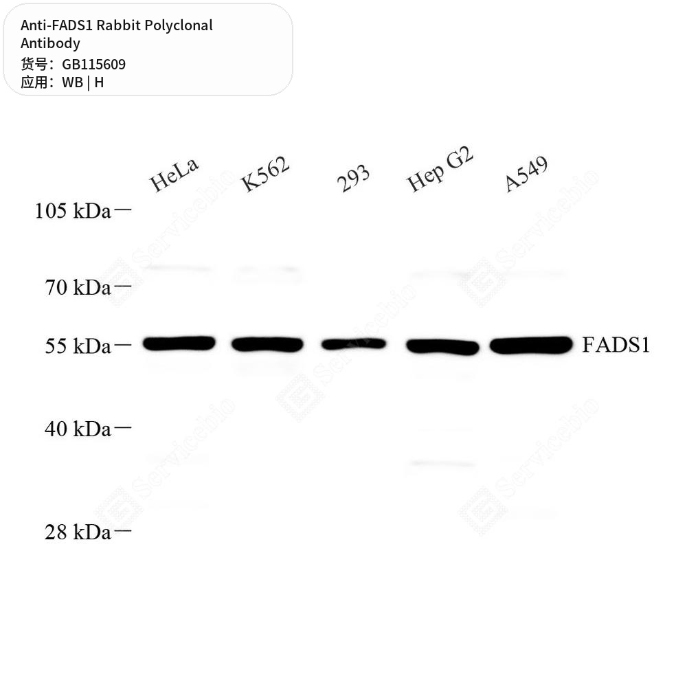 Антитела первичные, поликлональные кролика к FADS1 человека, 100 мкл