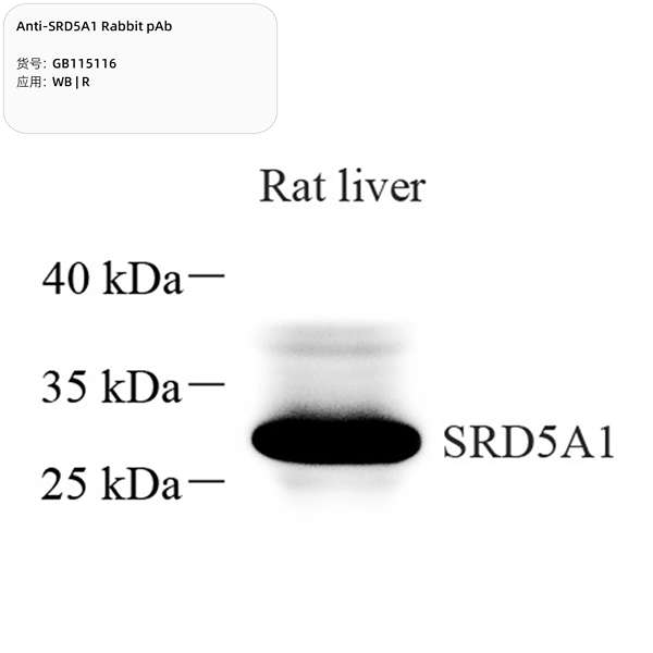Антитела первичные, поликлональные, SRD5A1, 100 мкл