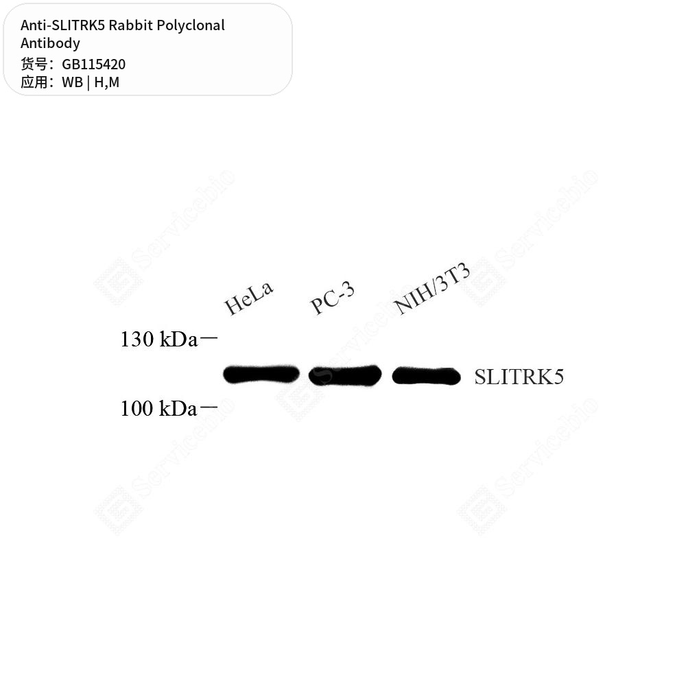 Антитела первичные, поликлональные кролика к SLITRK5 мыши, человека, 50 мкл