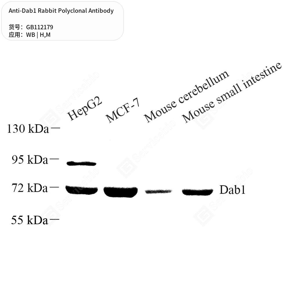 Антитела первичные, поликлональные кролика к Dab1 мыши, человека, 100 мкл
