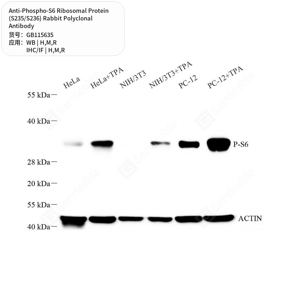 Антитела первич., полик. крол. к Phos.-S6 Ribosomal Protein (S235/S236) крысы, мыши, чел., 100 мкл