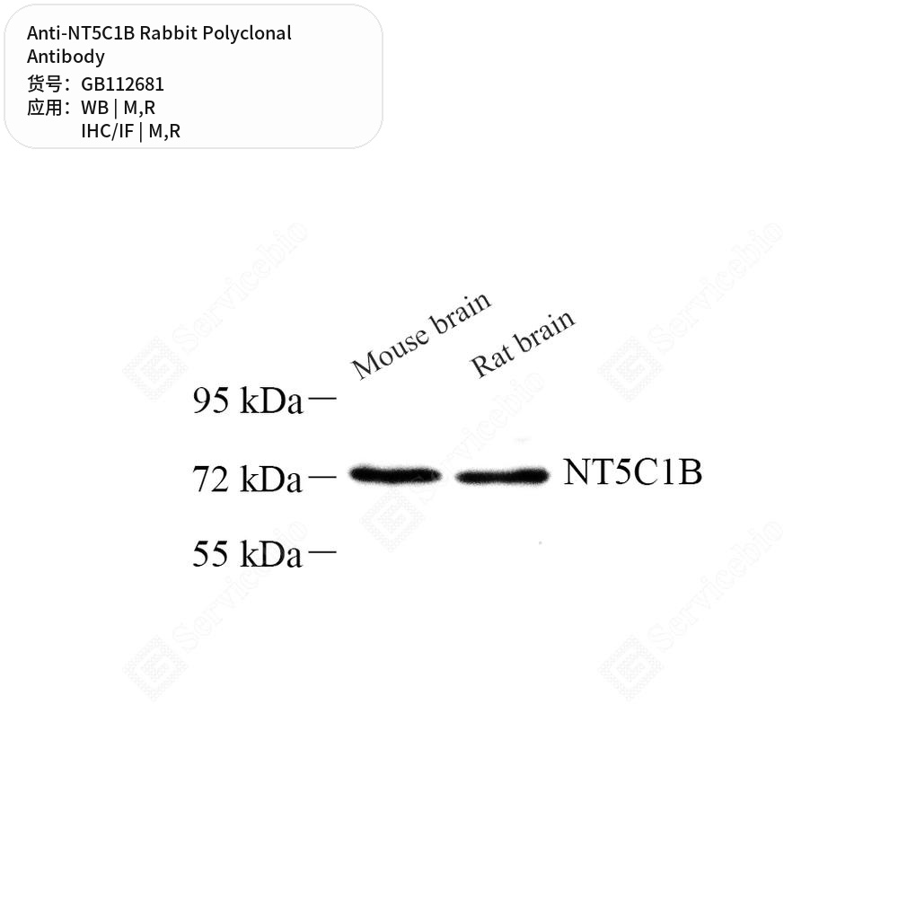 Антитела первичные, поликлональные кролика к NT5C1B крысы, мыши, 100 мкл