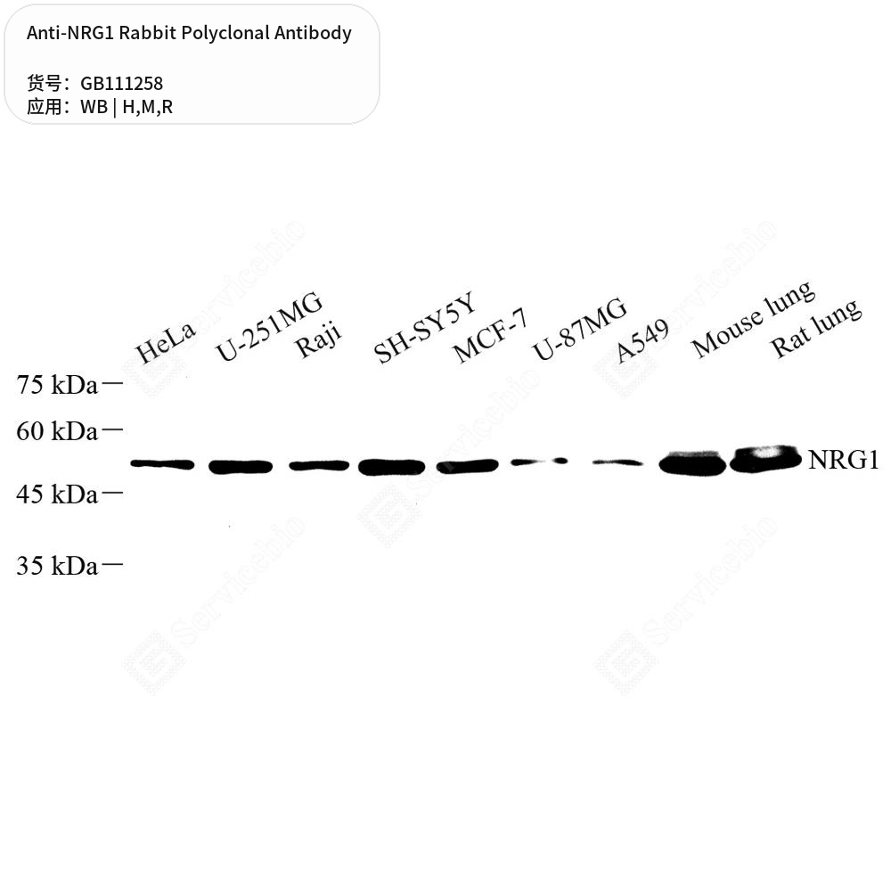 Антитела первичные, поликлональные кролика к NRG1 крысы, мыши, человека, 100 мкл