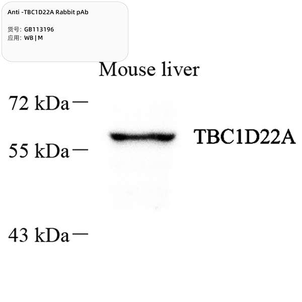 Антитела первичные, поликлональные, TBC1D22A, 100 мкл