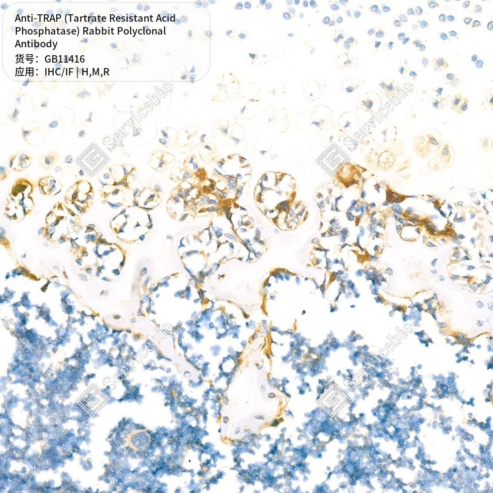 Антитела первичные, пол. крол. к TRAP (Tartrate Resistant Acid Phosphatase) кр. мыши, чел., 50 мкл