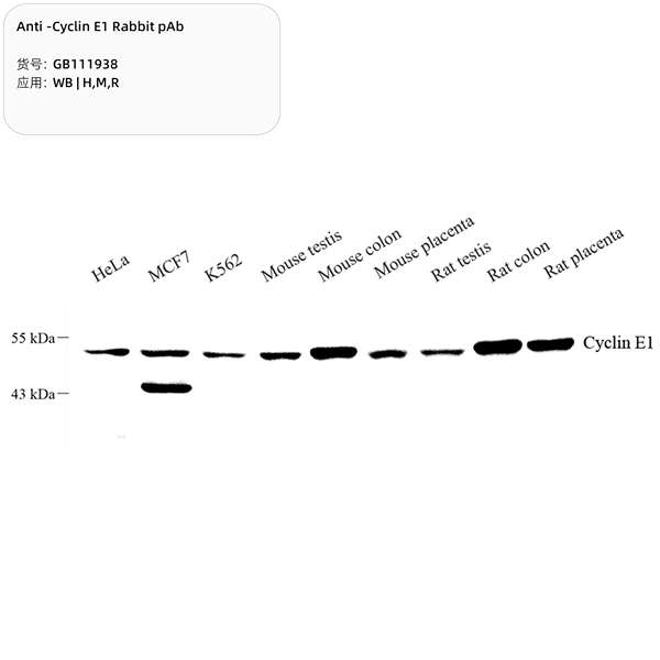 Антитела первичные, поликлональные, Cyclin E1, 100 мкл