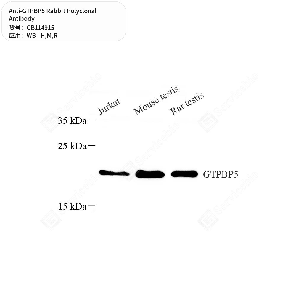 Антитела первичные, поликлональные кролика к GTPBP5 крысы, мыши, человека, 50 мкл