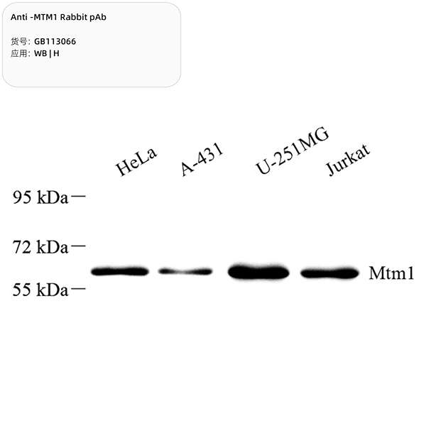 Антитела первичные, поликлональные, MTM1, 100 мкл