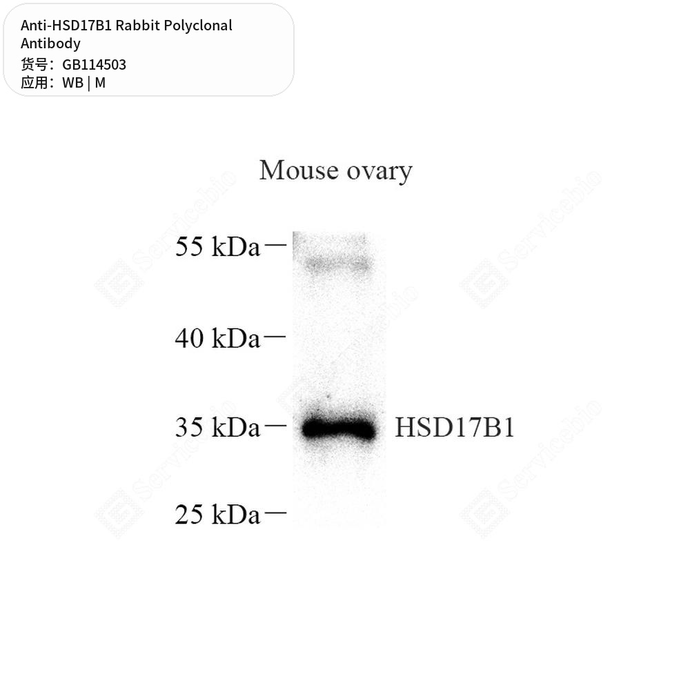 Антитела первичные, поликлональные кролика к HSD17B1 мыши, 100 мкл