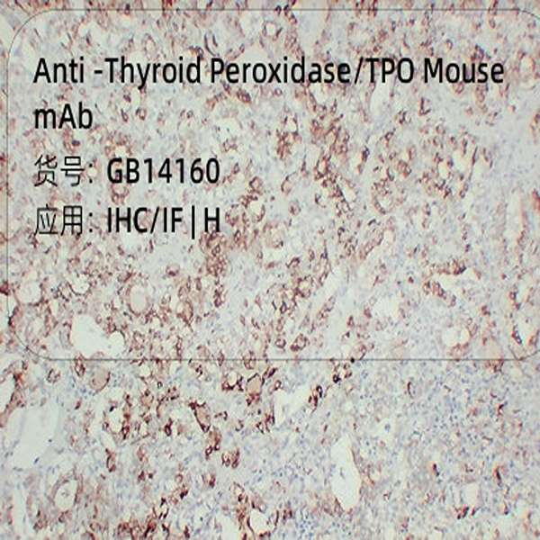 Антитела первичные, моноклональные, Thyroid Peroxidase/TPO, 50 мкл