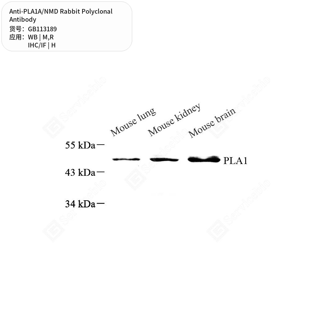 Антитела первичные, поликлональные кролика к PLA1A/NMD крысы, мыши, человека, 100 мкл