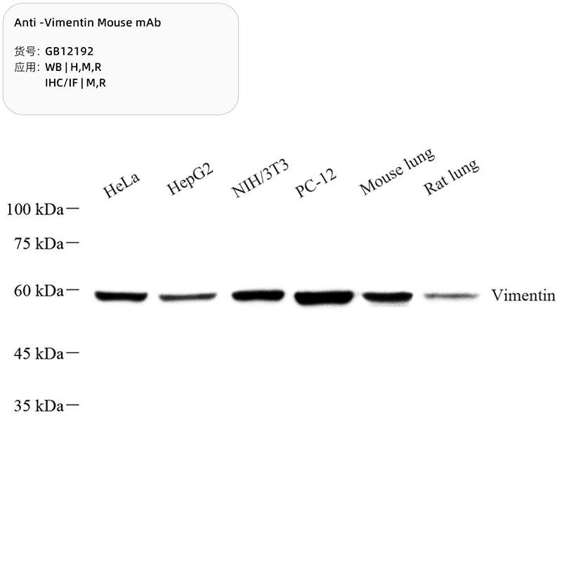 Антитела первичные, моноклональные, Vimentin, 100 мкл