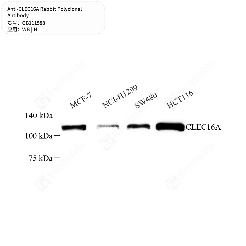 Антитела первичные, поликлональные кролика к CLEC16A человека, 50 мкл
