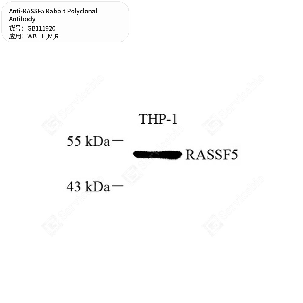 Антитела первичные, поликлональные кролика к RASSF5 крысы, мыши, человека, 100 мкл