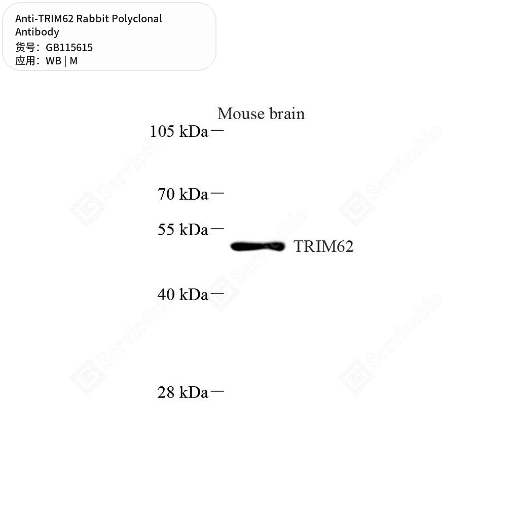 Антитела первичные, поликлональные кролика к TRIM62 мыши, 50 мкл