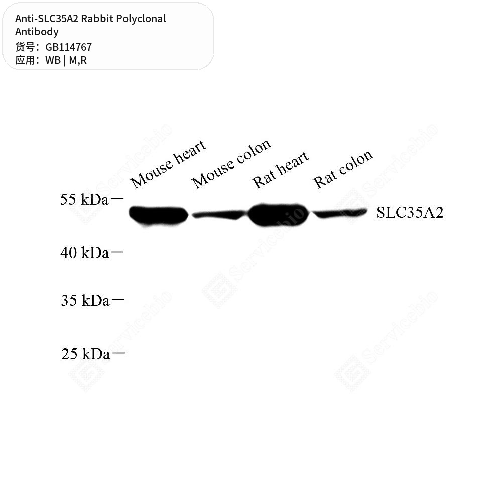 Антитела первичные, поликлональные кролика к SLC35A2 крысы, мыши, 50 мкл