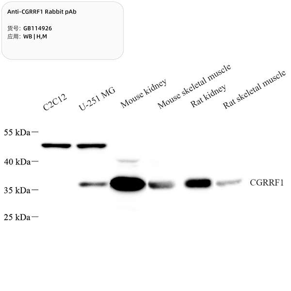 Антитела первичные, поликлональные, CGRRF1, 100 мкл