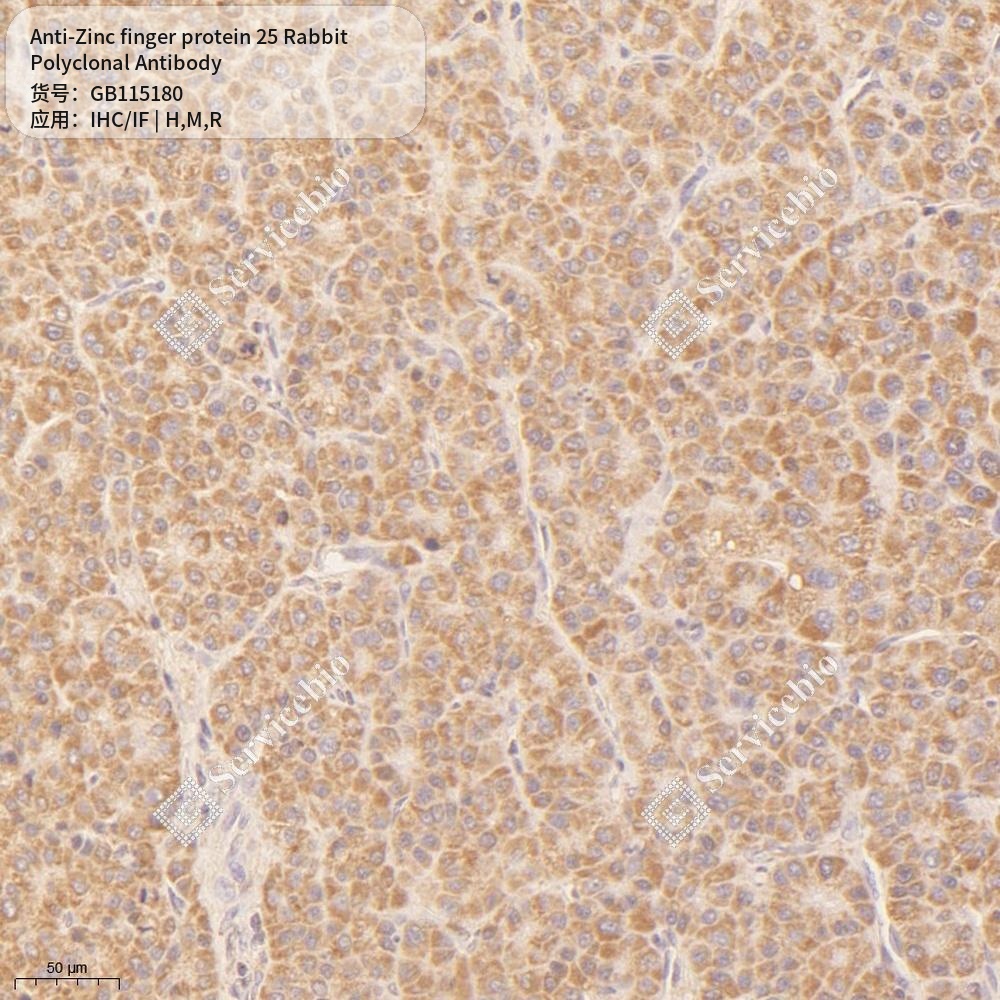 Антитела первичные, поликлональные кролика к Zinc finger protein 25 крысы, мыши, человека, 50 мкл
