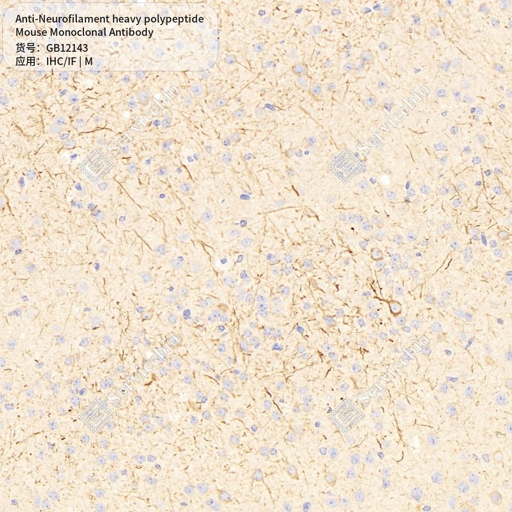 Антитела первичные, моноклональные мыши к Neurofilament heavy polypeptide мыши, 50 мкл