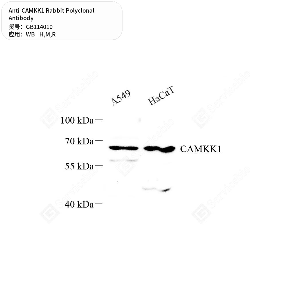 Антитела первичные, поликлональные кролика к CAMKK1 крысы, мыши, человека, 50 мкл