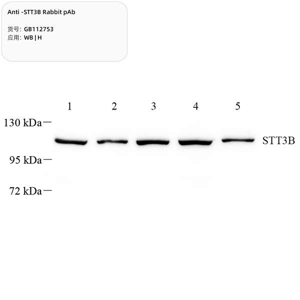 Антитела первичные, поликлональные, STT3B, 100 мкл