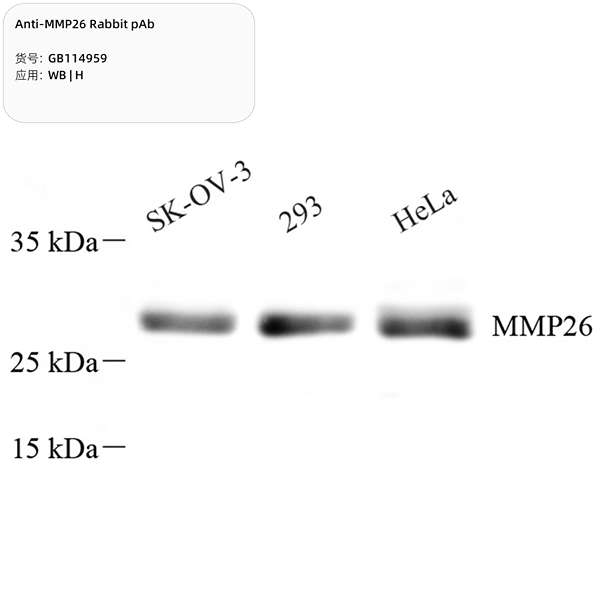 Антитела первичные, поликлональные, MMP26, 100 мкл