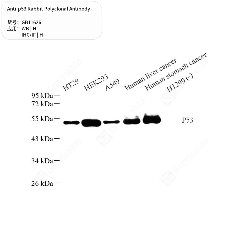 Антитела первичные, поликлональные кролика к p53 человека, 100 мкл