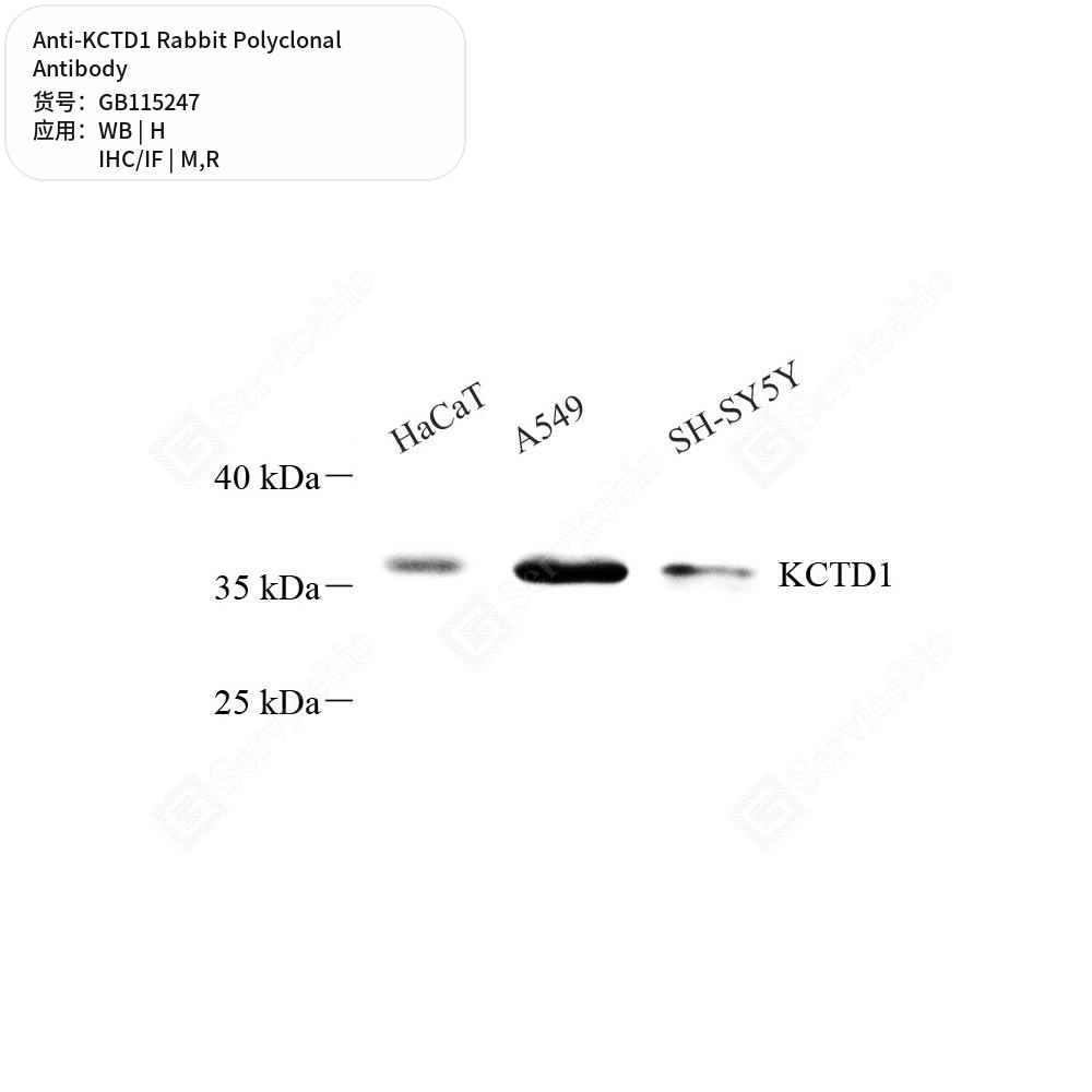 Антитела первичные, поликлональные кролика к KCTD1 крысы, мыши, человека, 100 мкл