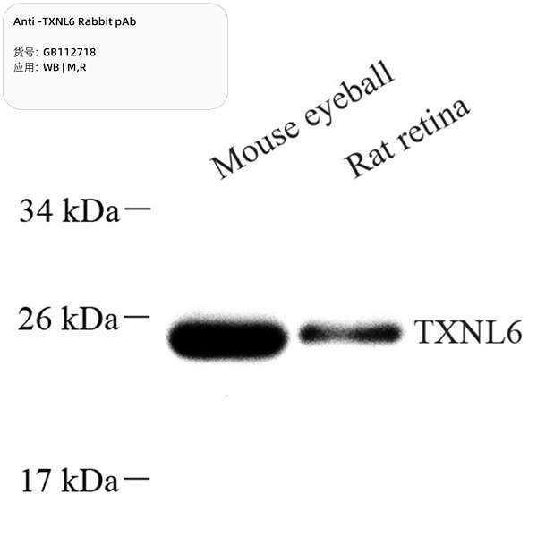 Антитела первичные, поликлональные, TXNL6, 100 мкл