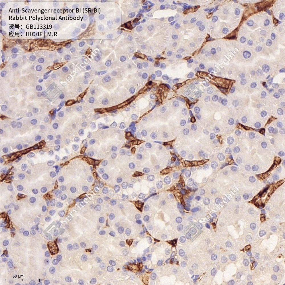 Антитела первичные, поликлональные кролика к Scavenger receptor BI (SR-BI) крысы, мыши, 50 мкл