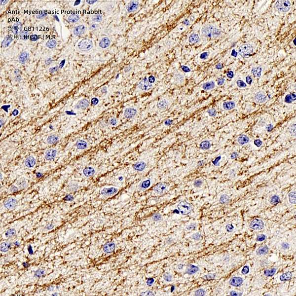 Антитела первичные, поликлональные, Myelin Basic Protein, 100 мкл