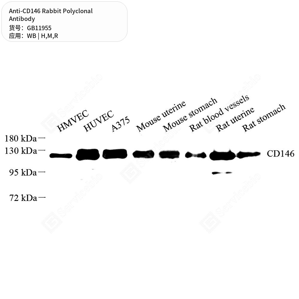 Антитела первичные, поликлональные кролика к CD146 крысы, мыши, человека, 50 мкл